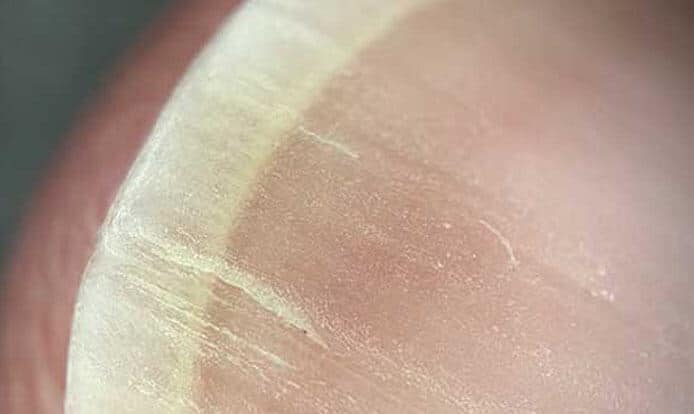 NanoSight x200 (official Retailer) 2025